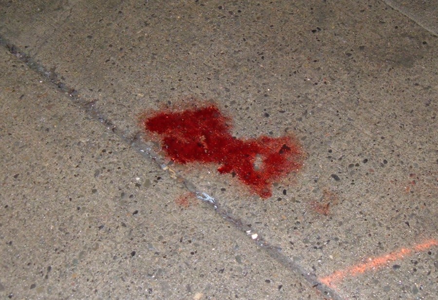 Armed robbery aftermath (courtesy owegopennysaver.com)
