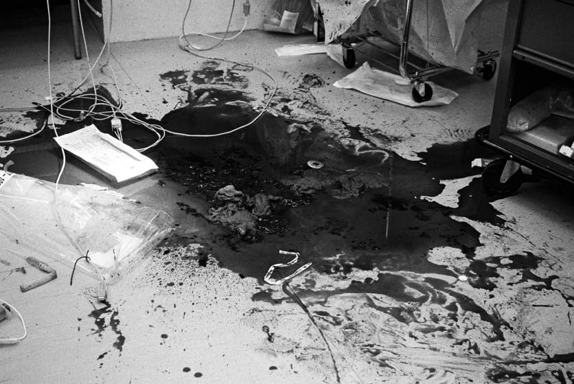 MEMPHIS, TENNESSEE    The aftermath of a chest gunshot wound treated in Emergency Room 1 at the Elvis Presley Memorial Trauma Center in Memphis, Tennessee. Memphis paramedic Patricia Artella, from the ambulance radio communications room, says "Have you ever seen them crack a chest? It's like a hog slaughter; blood on the walls, blood on the ceiling, half inch thick on the floor..."  (Photo by Zed Nelson)