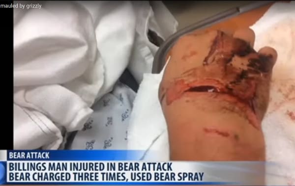Grizzly bear wounds (courtesy ammoland.com)
