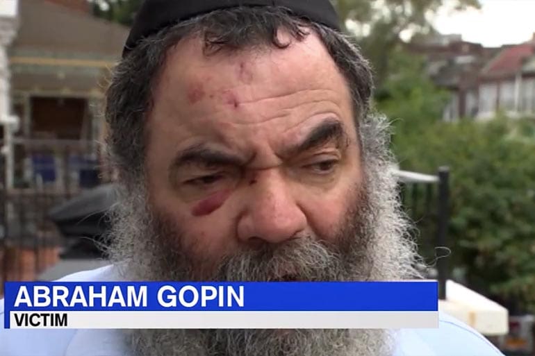 brooklyn rabbi attacked beaten stone